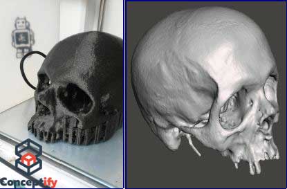 Scann et impression 3D d'un crâne humain